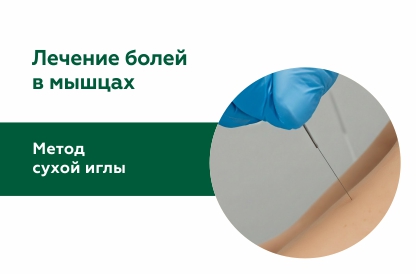Метод сухой иглы