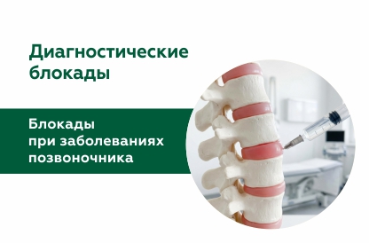 Лечебно-диагностические блокады при заболеваниях позвоночника