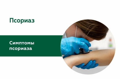 Псориаз