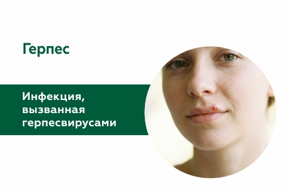 Герпес