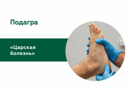 Подагра - «царская болезнь»