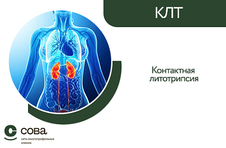 Контактная литотрипсия (КЛТ)