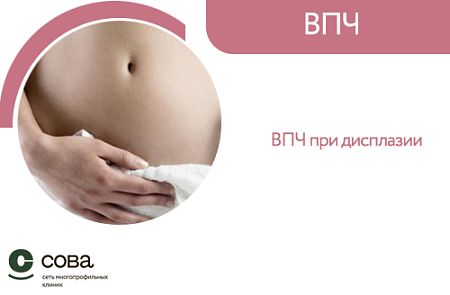 ВПЧ при дисплазии