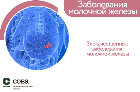 Злокачественные заболевания молочной железы