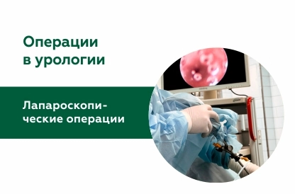 Лапароскопические операции в урологии