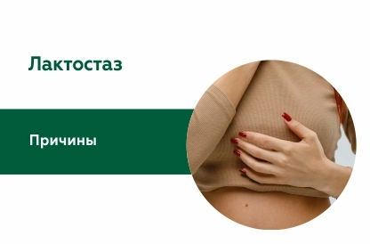 Лечение лактостаза
