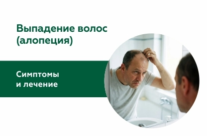 Что нужно знать о выпадении волос