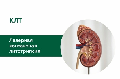 Лазерная контактная литотрипсия (КЛТ)