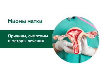 Миома матки