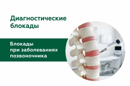 Лечебно-диагностические блокады при заболеваниях позвоночника