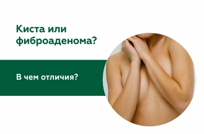 Киста или фиброаденома – в чем отличия?