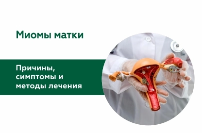 Миомы: причины, симптомы, методы лечения