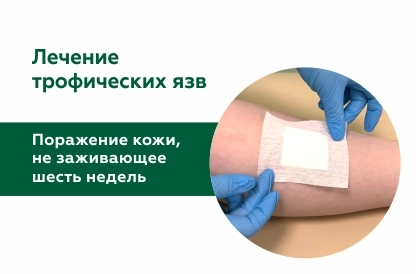 Трофическая язва – это поражение кожи, которое не заживает на протяжении шести недель