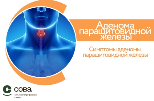 Аденома паращитовидной железы