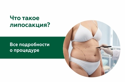 Что такое липосакция?