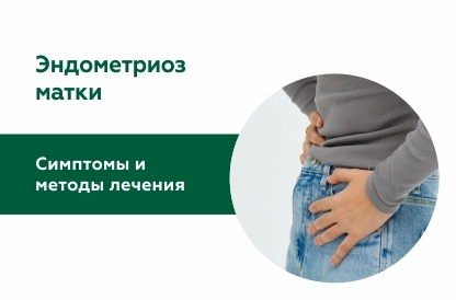 Эндометриоз матки: симптомы и методы лечения